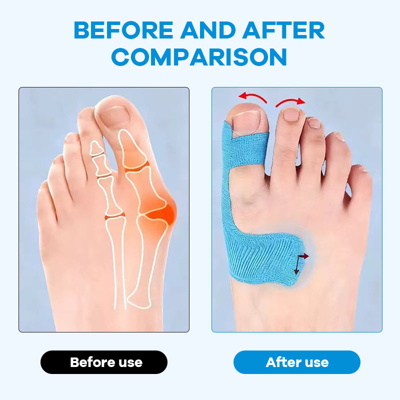 Färdigskuren kinesiologitejp för hallux valgus